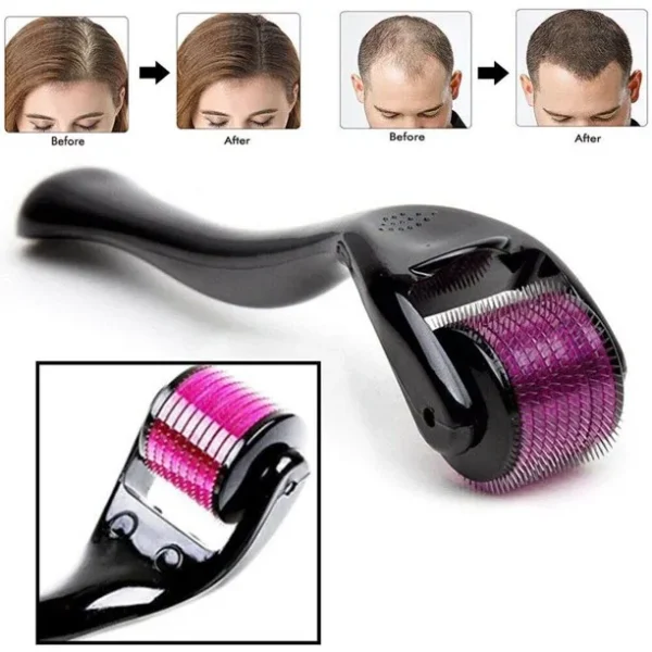 540 micro needle derma roller therapy skin ( 0.50mm)