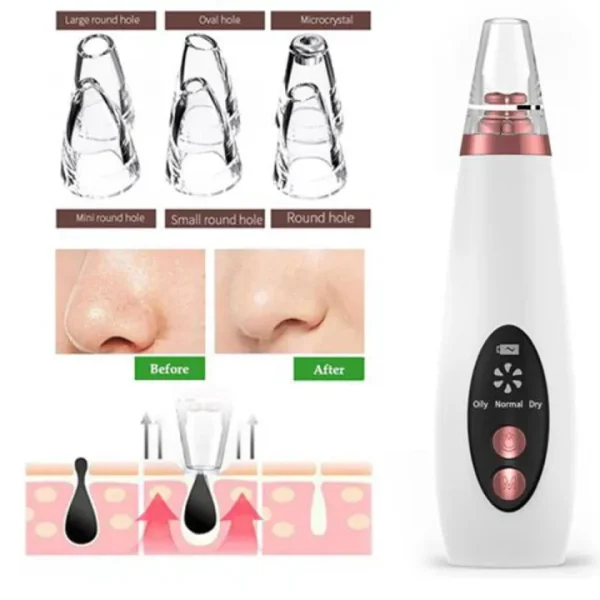 blackhead remover instrument black dot remover acne vacuum suction face clean black head pore cleaning beauty skin care tool black head remover darma roller