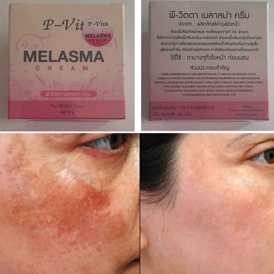 Bioaqua P Vita Melasma Mesta Whitening Cream -10 gm (Thailand) - Image 6